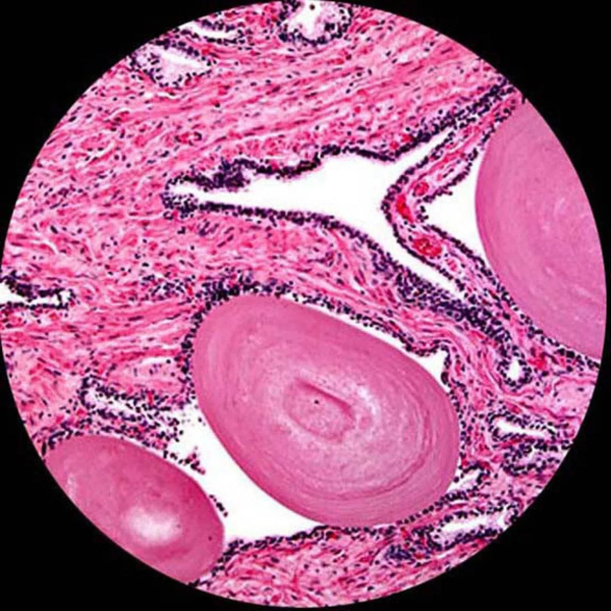 AmScope B120 Series Binocular Compound Microscope 40X-2000X Magnification with LED, Siedentopf Head, Digital Camera and 3D Stage