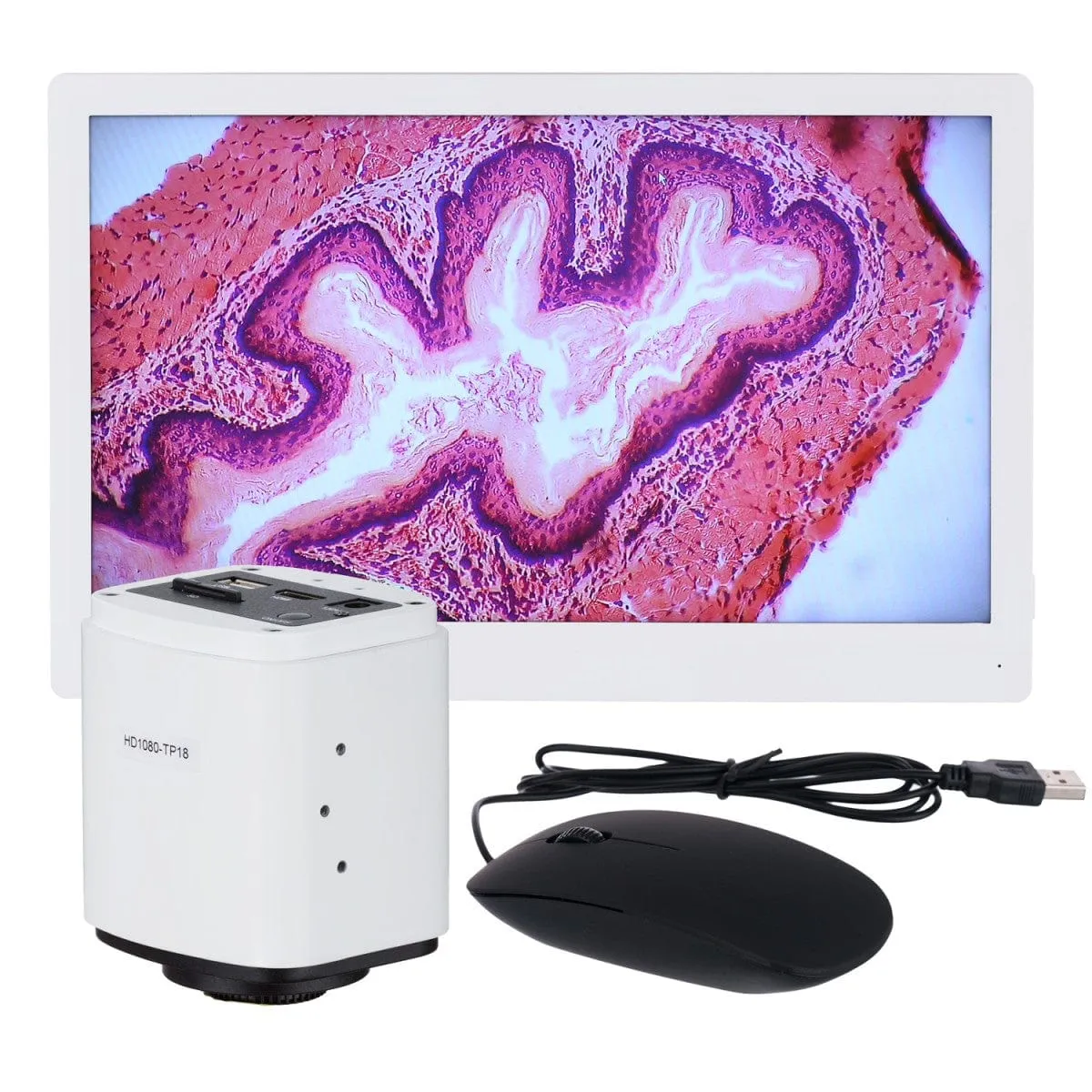 AmScope IN480 Series Inverted Infinity-corrected Phase-contrast Trinocular Compound Microscope 40X-1500X Magnification with Koehler Illumination and 11.6" 60fps Real-time Imaging system