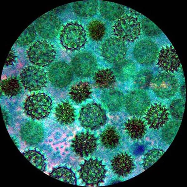 AmScope IN480 Series Inverted Infinity-corrected Phase-contrast Trinocular Compound Microscope 40X-1500X Magnification with Koehler Illumination and 11.6" 60fps Real-time Imaging system